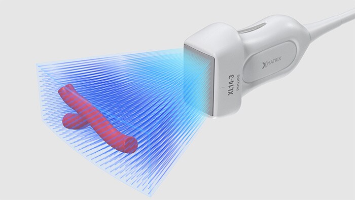 Risoluzione 3D-4D di qualità elevata