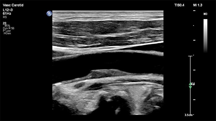 Affidabilità diagnostica nell'imaging vascolare