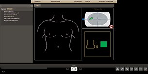 Immagine della registrazione con il trasduttore per Philips AI Breast