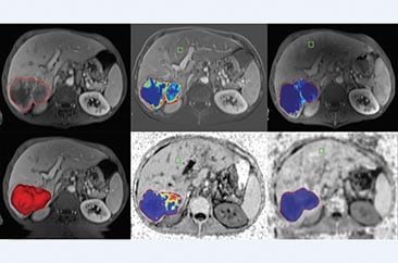 multi-modality-tumor-tracking-qeasl