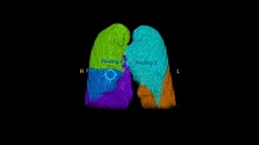 multi-modality-tumor-tracking-qeasl