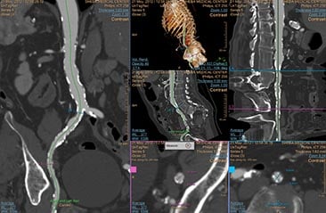 multi-modality-tumor-tracking-qeasl