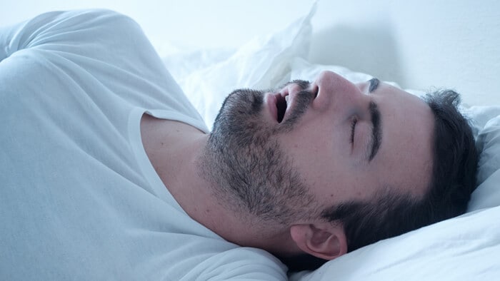 Sai qual è il modo migliore per dormire se soffri di OSA?
