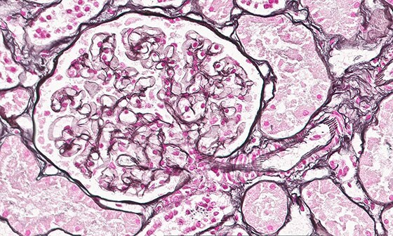 Oncologia patologica digitale Philips IntelliSite