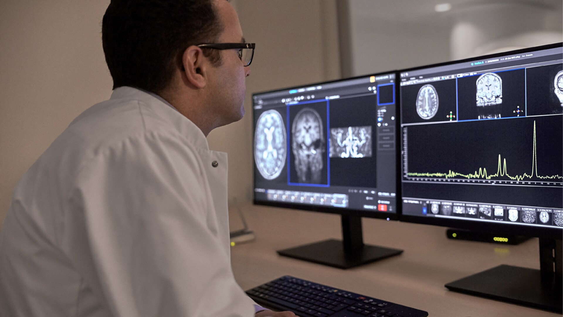 Philips presenta in Italia il rivoluzionario scanner per risonanza magnetica MR 7700