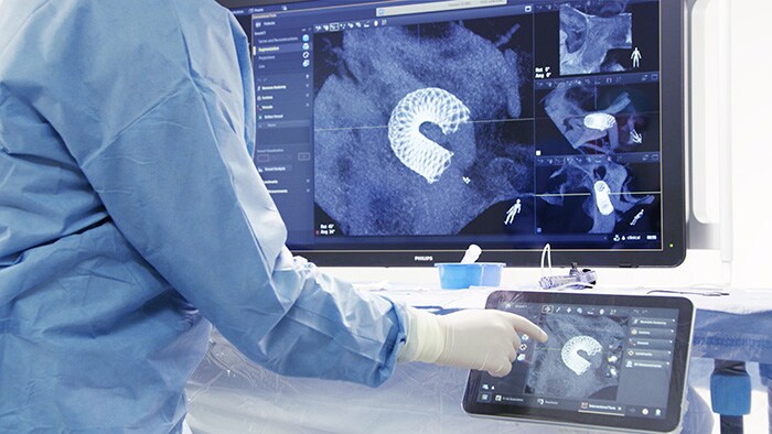 Philips received US FDA clearance for its SmartCT (Cone Beam CT) application for the Azurion image-guided therapy system and introduced its ClarifEye Augmented Reality Surgical Navigation. 