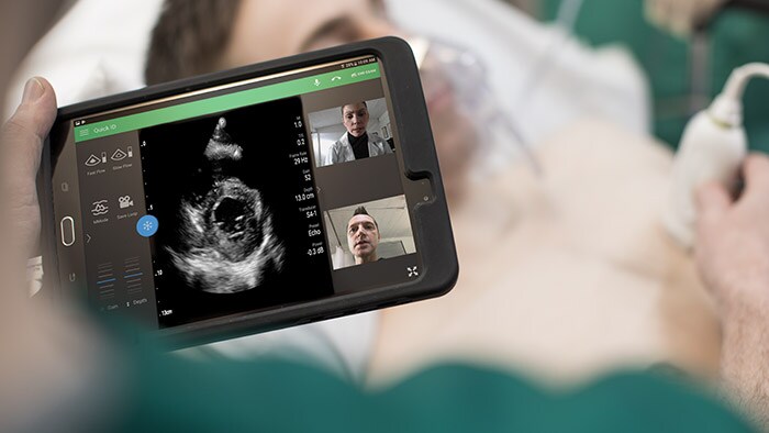 Philips Lumify handheld ultrasound has become ‘instrumental’ for doctors fighting COVID-19