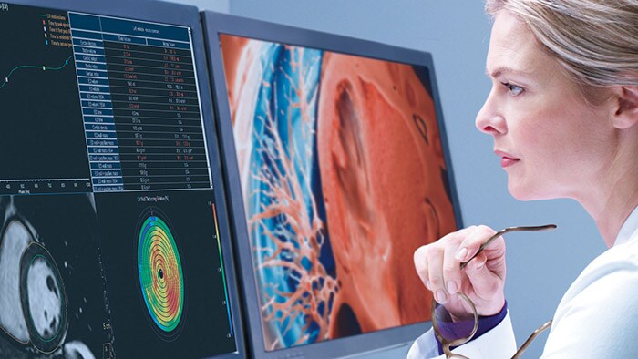Philips Advanced Visualization Workspace – IntelliSpace Portal 12 - wins EuroMinnie award for Best New Radiology Software
