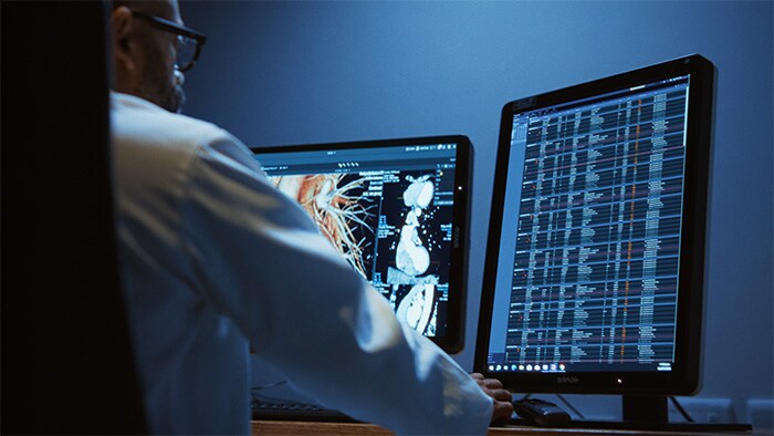 Philips showcases advanced visualization at RSNA 2025