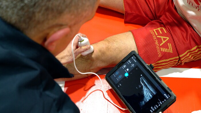 Olimpia Milano sceglie l’ecografo portatile Philips Lumify per valutare direttamente sul parquet le condizioni dei propri atleti 